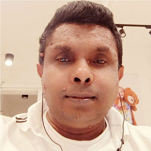 Mr. Niranga Iroshan