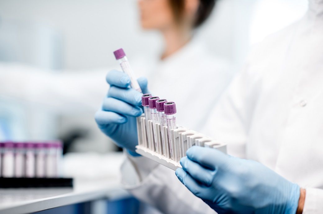 UC Riverside discovers bacteria that break down forever chemicals